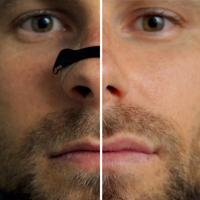 ClearNose – Magnetische Neusstrip voor Vrij Ademen