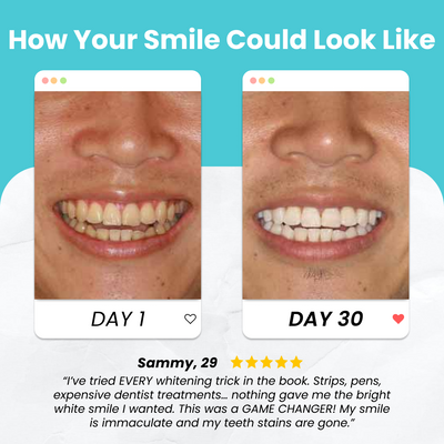 Oral360 – Grondige Reiniging in Seconds