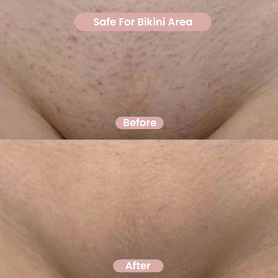 SilkSkin – Glad, Zonder Gedoe
